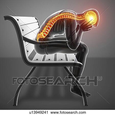 Man with back pain, computer illustration. View Large Photo Image Stock Image - Man with back pain, computer illustration.. Fotosearch