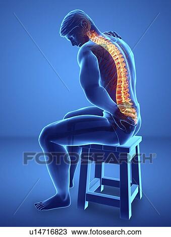 Man with back pain, computer illustration. View Large Photo Image Stock Image - Man with back pain, computer illustration.. Fotosearch