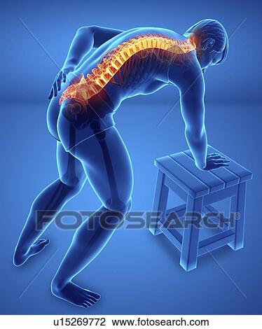 Man with back pain, computer illustration. View Large Photo Image Stock Image - Man with back pain, computer illustration.. Fotosearch