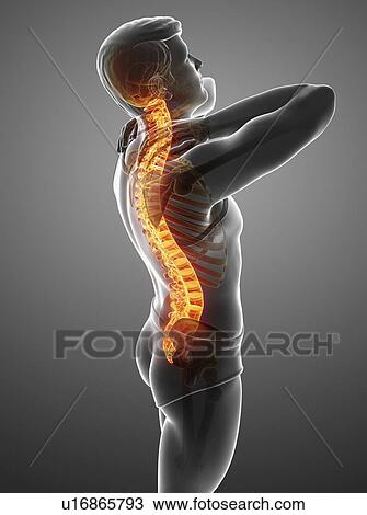 Stock Image - Man with back pain, computer illustration.. Fotosearch