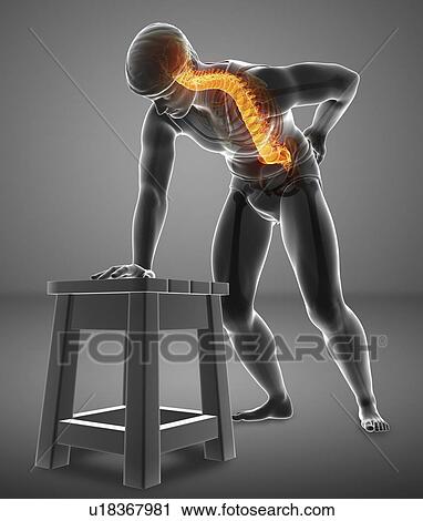 Stock Image - Man with back pain, computer illustration.. Fotosearch