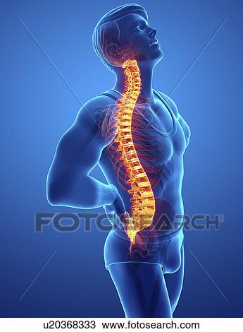 Stock Image - Man with back pain, computer illustration.. Fotosearch