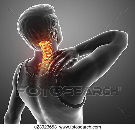 Man with back pain, computer illustration. View Large Photo Image Stock Image - Man with back pain, computer illustration.. Fotosearch