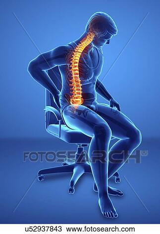 Stock Image - Man with back pain, computer illustration.. Fotosearch