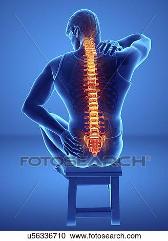 Man with back pain, computer illustration. View Large Photo Image Stock Image - Man with back pain, computer illustration.. Fotosearch