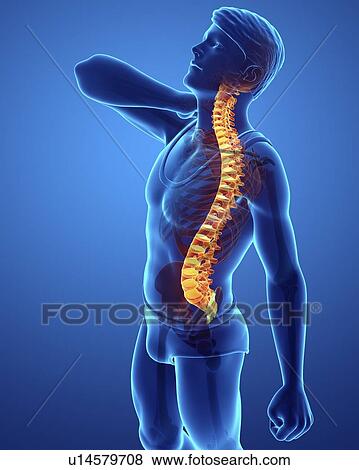 Stock Photo - Man with back pain, computer illustration.. Fotosearch