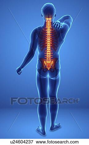 Man with back pain, computer illustration. View Large Photo Image Stock Photo - Man with back pain, computer illustration.. Fotosearch