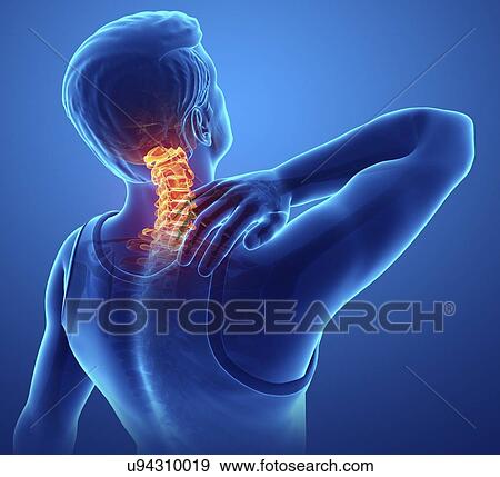 Stock Photo - Man with back pain, computer illustration.. Fotosearch