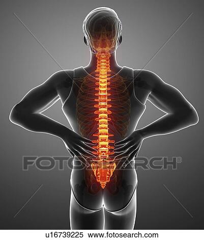 Man with back pain, computer illustration. View Large Photo Image Stock Photography - Man with back pain, computer illustration.. Fotosearch