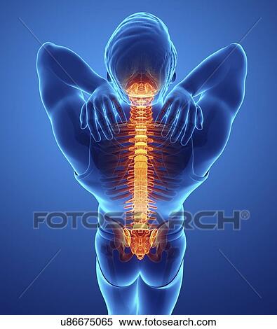 Stock Photography - Man with back pain, computer illustration.. Fotosearch