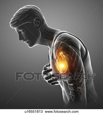 Man with chest pain, computer illustration. View Large Photo Image Stock Image - Man with chest pain, computer illustration.. Fotosearch