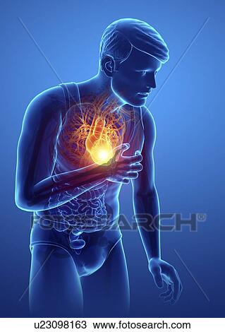 Stock Image - Man with chest pain, computer illustration.. Fotosearch