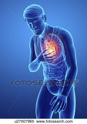 Man with chest pain, computer illustration. View Large Photo Image Stock Photography - Man with chest pain, computer illustration.. Fotosearch