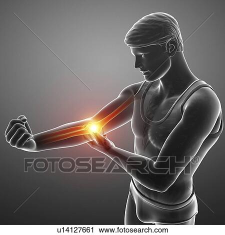 Man with elbow pain, computer illustration. View Large Photo Image Stock Image - Man with elbow pain, computer illustration.. Fotosearch