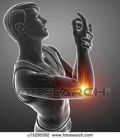 Man with elbow pain, computer illustration. View Large Photo Image Stock Image - Man with elbow pain, computer illustration.. Fotosearch