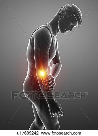 Stock Image - Man with elbow pain, computer illustration.. Fotosearch