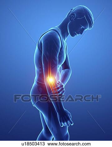 Stock Image - Man with elbow pain, computer illustration.. Fotosearch