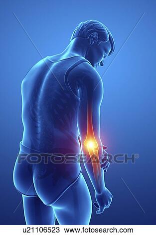 Stock Image - Man with elbow pain, computer illustration.. Fotosearch