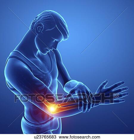 Stock Image - Man with elbow pain, computer illustration.. Fotosearch