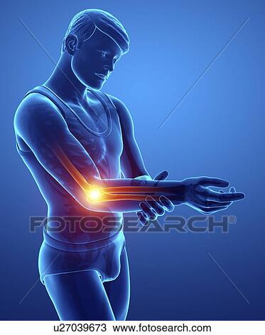 Man with elbow pain, computer illustration. View Large Photo Image Stock Image - Man with elbow pain, computer illustration.. Fotosearch