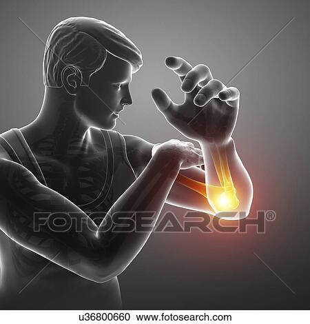 Man with elbow pain, computer illustration. View Large Photo Image Stock Image - Man with elbow pain, computer illustration.. Fotosearch