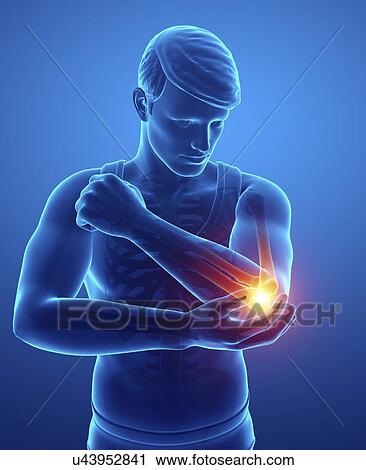 Man with elbow pain, computer illustration. View Large Photo Image Stock Image - Man with elbow pain, computer illustration.. Fotosearch