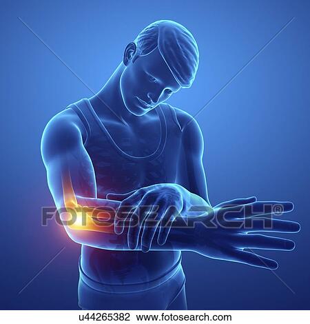 Stock Image - Man with elbow pain, computer illustration.. Fotosearch