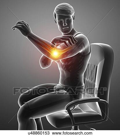 Man with elbow pain, computer illustration. View Large Photo Image Stock Image - Man with elbow pain, computer illustration.. Fotosearch