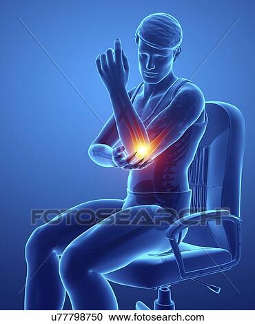 Man with elbow pain, computer illustration. View Large Photo Image Stock Image - Man with elbow pain, computer illustration.. Fotosearch