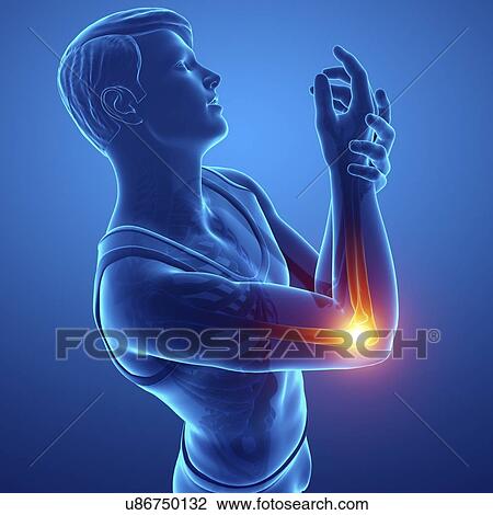 Man with elbow pain, computer illustration. View Large Photo Image Stock Image - Man with elbow pain, computer illustration.. Fotosearch