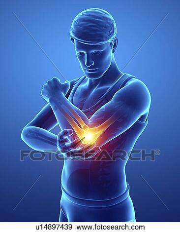 Man with elbow pain, computer illustration. View Large Photo Image Stock Photo - Man with elbow pain, computer illustration.. Fotosearch