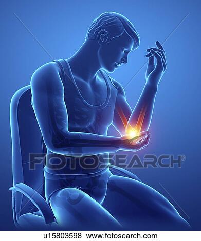 Man with elbow pain, computer illustration. View Large Photo Image Stock Photo - Man with elbow pain, computer illustration.. Fotosearch
