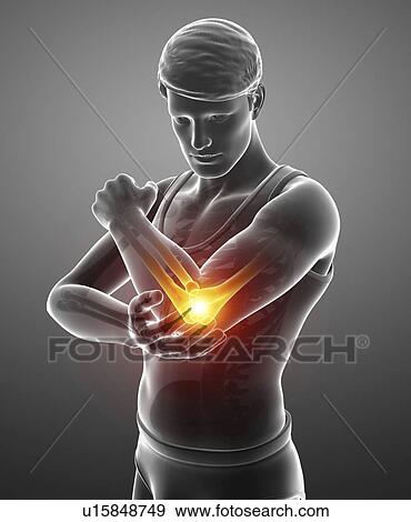 Man with elbow pain, computer illustration. View Large Photo Image Stock Photo - Man with elbow pain, computer illustration.. Fotosearch