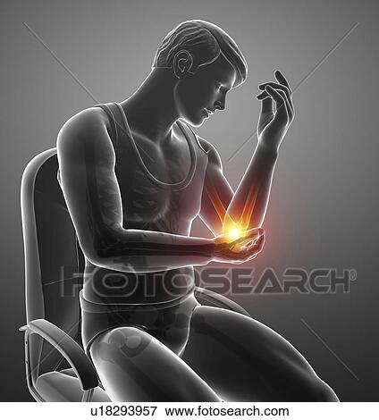 Stock Photo - Man with elbow pain, computer illustration.. Fotosearch
