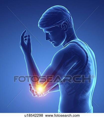 Stock Photo - Man with elbow pain, computer illustration.. Fotosearch