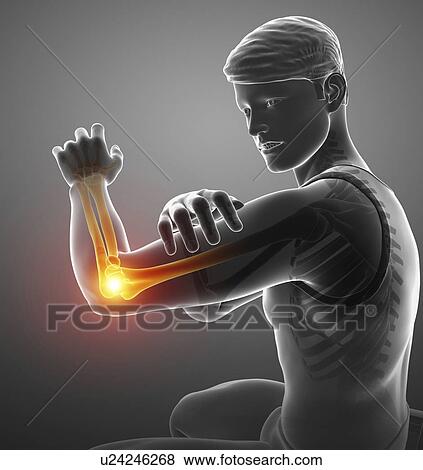 Stock Photo - Man with elbow pain, computer illustration.. Fotosearch