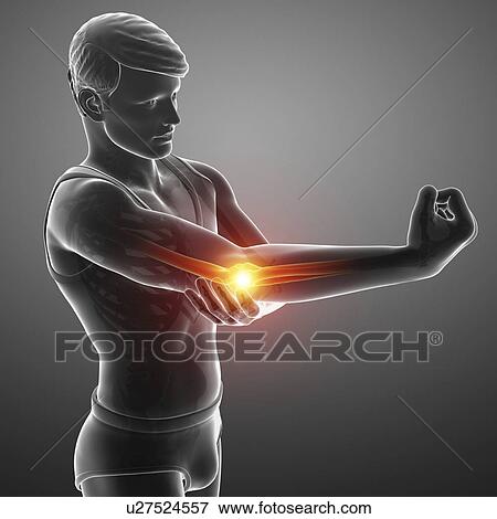 Man with elbow pain, computer illustration. View Large Photo Image Stock Photo - Man with elbow pain, computer illustration.. Fotosearch