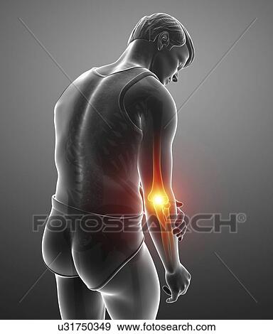Man with elbow pain, computer illustration. View Large Photo Image Stock Photo - Man with elbow pain, computer illustration.. Fotosearch