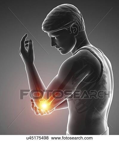 Stock Photo - Man with elbow pain, computer illustration.. Fotosearch