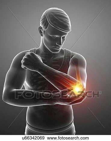 Stock Photo - Man with elbow pain, computer illustration.. Fotosearch