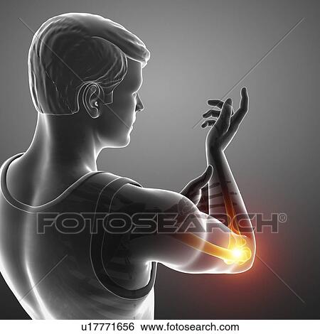 Stock Photograph - Man with elbow pain, computer illustration.. Fotosearch