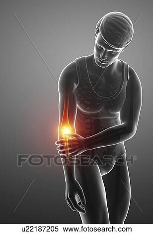 Stock Photography - Man with elbow pain, computer illustration.. Fotosearch