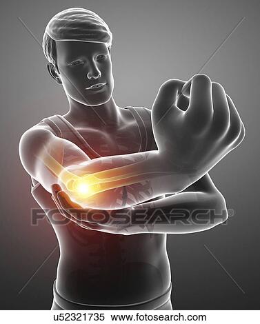 Stock Photography - Man with elbow pain, computer illustration.. Fotosearch