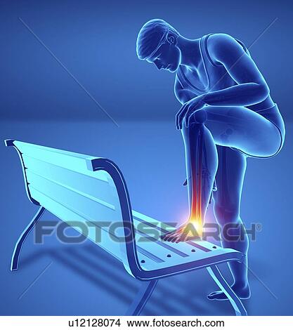 Man with foot pain, computer illustration. View Large Photo Image Picture - Man with foot pain, computer illustration.. Fotosearch