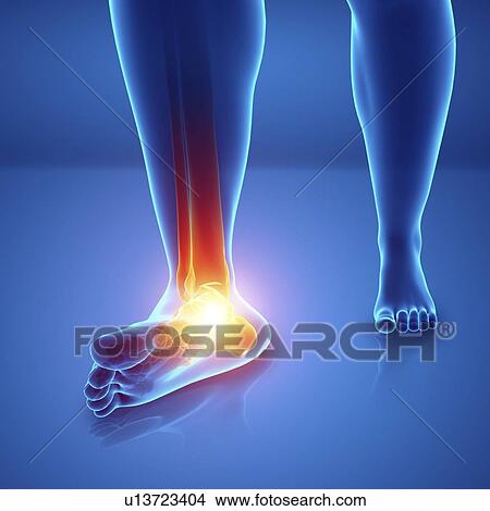 Picture - Man with foot pain, computer illustration.. Fotosearch