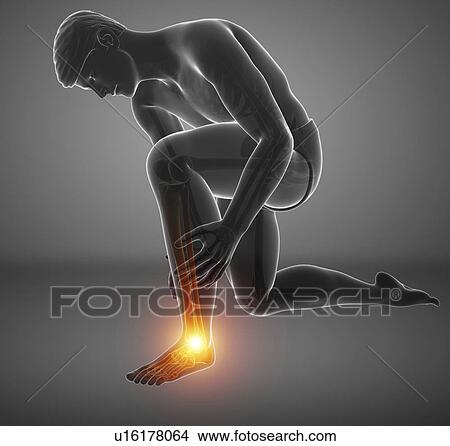 Man with foot pain, computer illustration. View Large Photo Image Picture - Man with foot pain, computer illustration.. Fotosearch