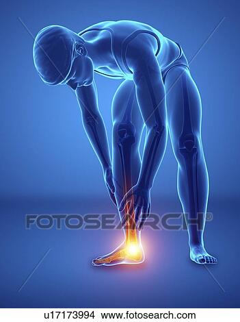 Picture - Man with foot pain, computer illustration.. Fotosearch