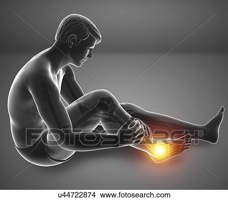 Man with foot pain, computer illustration. View Large Photo Image Picture - Man with foot pain, computer illustration.. Fotosearch