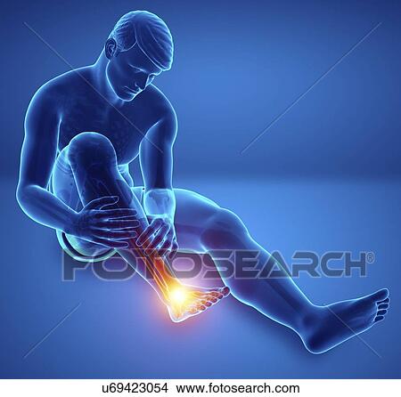 Man with foot pain, computer illustration. View Large Photo Image Picture - Man with foot pain, computer illustration.. Fotosearch