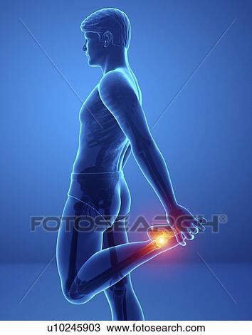 Man with foot pain, computer illustration. View Large Photo Image Stock Image - Man with foot pain, computer illustration.. Fotosearch